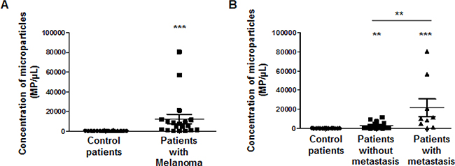 Immunodetection with TsCD146 mAb of CD146 expressed on microparticles in plasma samples from patients with melanoma.