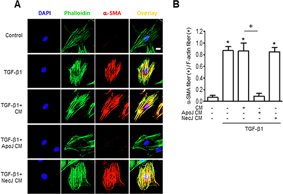Conditioned medium from RAW 264.7 cells exposed to apoptotic cells suppresses TGF-&#x03B2;1 promotion of &#x03B1;-SMA stress fibers.