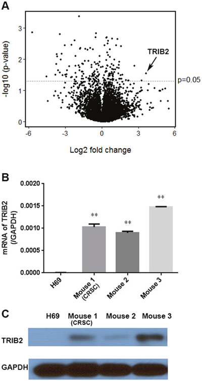 TRIB2 expression in Cisplatin-resistant SCLC cells.