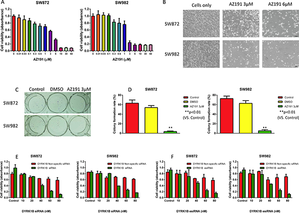 Inhibition of DYRK1B by kinase inhibitor AZ191 or RNAi blocks proliferation in liposarcoma cell lines.