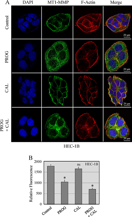 Localization of MT1-MMP in HEC-1B cells.