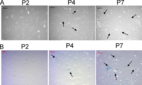 Morphological changes and &#x03B2;-galactosidase staining of human primary osteoblasts of different passages confirmed the osteoblast senescence at later passages.