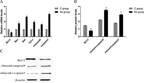 The effects of Se on apoptosis of oral squamous carcinoma cells.