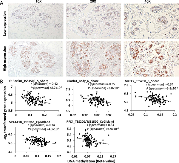 DNMT3A protein expression patterns by immunohistochemistry in histologically normal breast tissues (A) and correlations between age-related DNA methylation and gene expression (B).