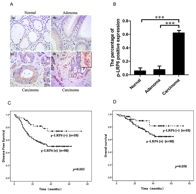 Immuno-staining of p-LRP6 correlated with outcome of colorectal cancers.
