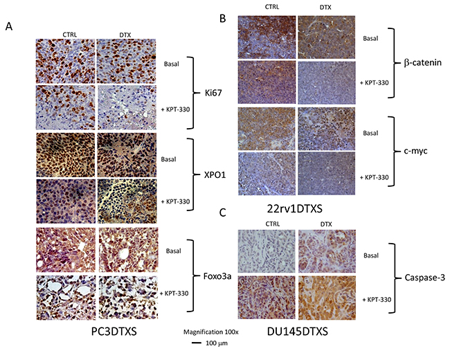Immunohistochemical analyses of PCa xenograft treated with DTX, KPT330 or combinations in vivo.