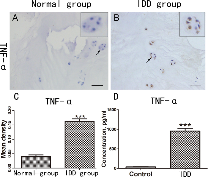 TNF-&alpha; is increased in degenerative IVD and peripheral serum.