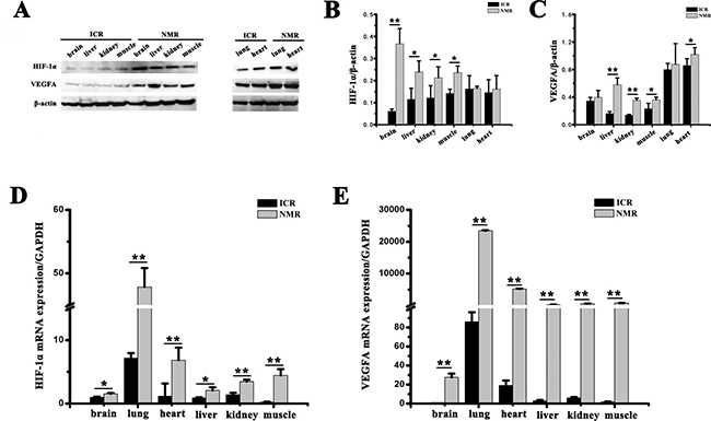 Expression of HIF-1&#x03B1; and VEGFA in brain, lung, heart, liver, kidney and muscle.