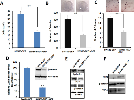 Figure 2. PKD1 overexpression decreases tumorigenic phenotypes by inhibiting the nuclear transcriptional activity of &#x03B2;-catenin in SW480 colon cancer cells.