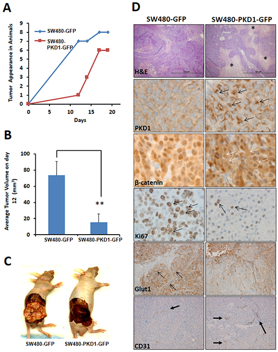 Figure 6. PKD1 overexpression delays tumor growth in xenograft mouse model.