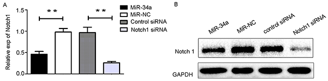 The transfection of miR3-4a mimics or Notch1 siRNA.