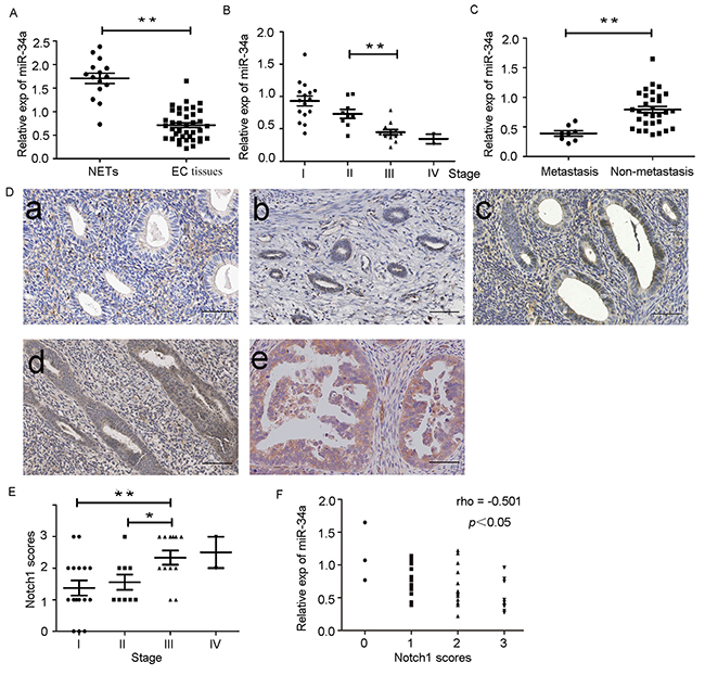 Down-regulation of miR-34a in endometrial cancer tissues is negatively correlated with expression of Notch1.