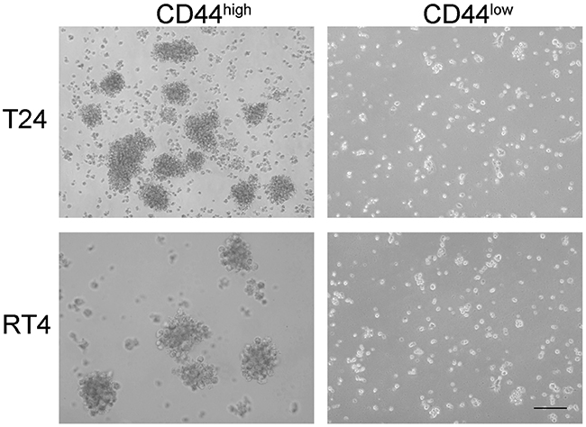 Cancer stem cell sphere formation assay on CD44high and CD44low cells from two different bladder cancer cell lines.