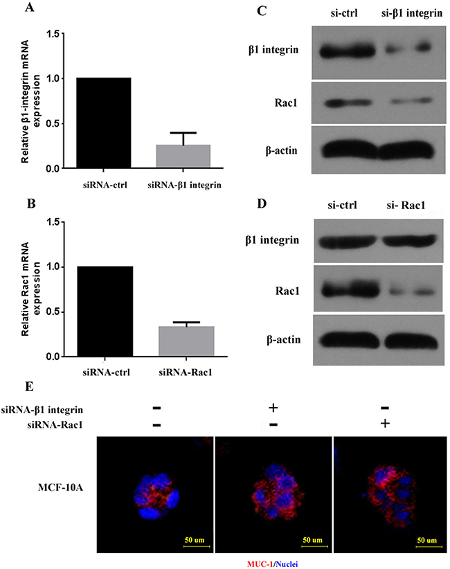 &#x03B2;1 integrin and Rac1 expression and polarity of breast cancer cell lines with silencing of &#x03B2;1 integrin and Rac1.