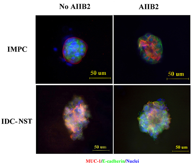 Polarity alterations induced by the &#x03B2;1 integrin inhibitor AIIB2.