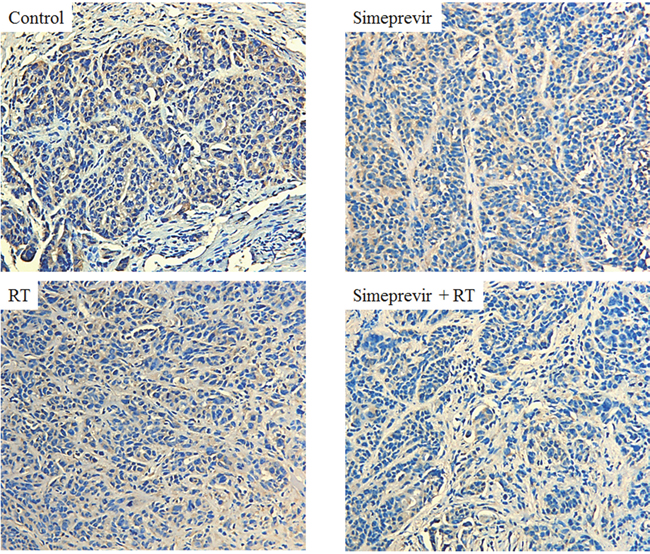 Immunohistochemical staining of in vivo breast tumor harvested from mice.