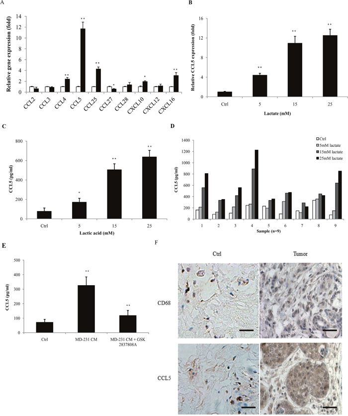 Lactic acid induced the secretion of CCL5 in human macrophages.