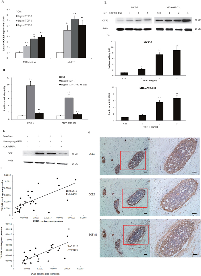 TGF-&#x03B2; signaling regulated the expression of CCR5.