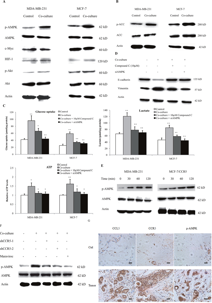 CCL5-CCR5 axis induced aerobic glycolysis by regulation of AMPK signaling.