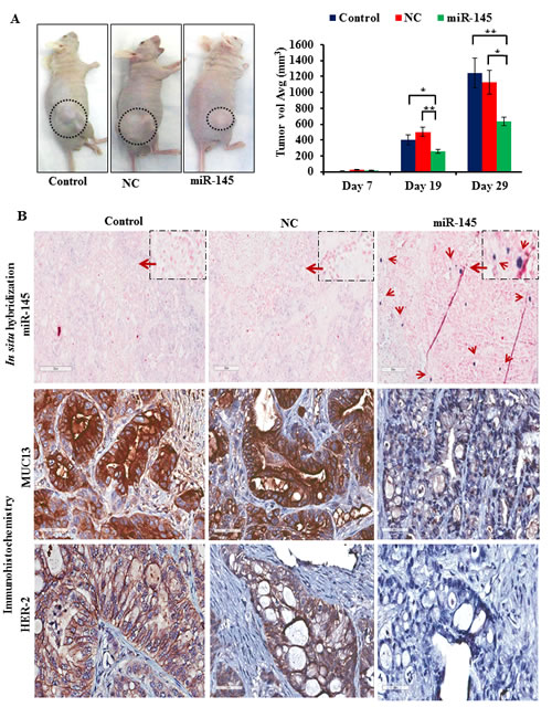Fig.5: miR-145 inhibits tumor growth in vivo.