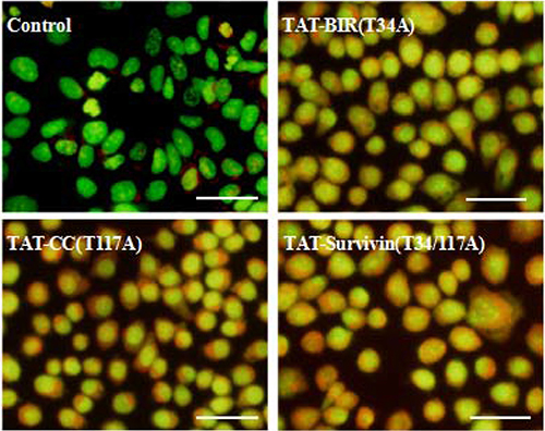 Detection of autophagy of treated Bcap-37 cells using acridine orange staining.