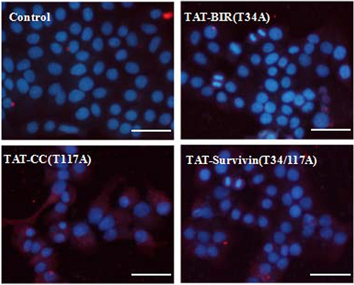 Detection of LC3B in treated Bcap-37 cells using immunofluorescence assay.