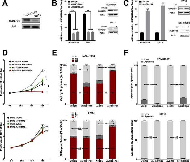 HSD17B4 exerts tumor suppressive effect in ACC cells NCI-H295R and SW13 showing.