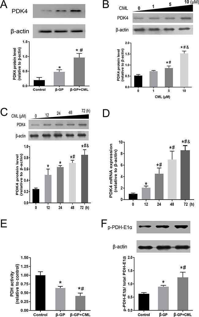 PDK4 expression is increased during VSMC calcification.