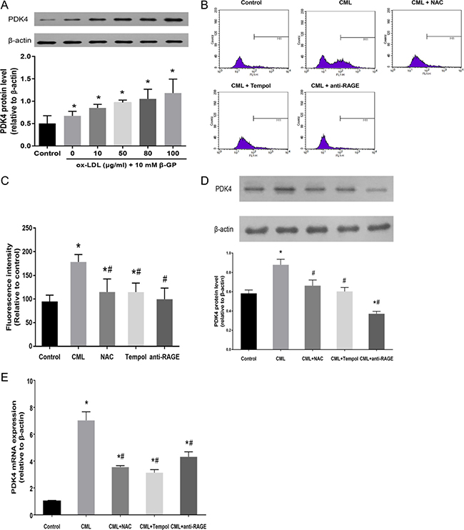 PDK4 expression is correlated with the level of intracellular oxidative stress.