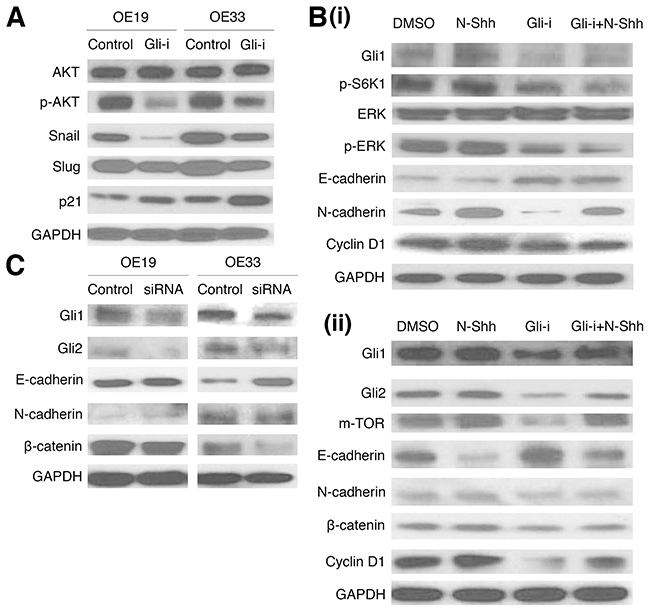 Gli inhibition and siRNA knockdown reduce EMT and cell cycle activity in EAC cell lines.