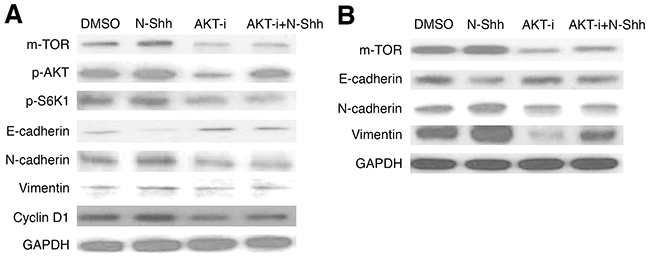 AKT inhibition reduces EMT and cell cycle activity in EAC cell lines.