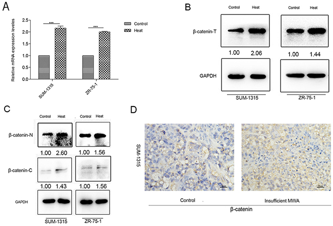 &#x03B2;-catenin increased in heat-treated breast cancer cells and insufficient MWA tumor tissues.
