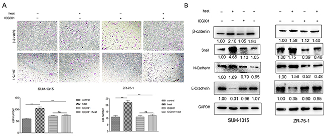 ICG001 suppressed metastasis induced by insufficient MWA in SUM-1315 and ZR-751 breast cancer cells.
