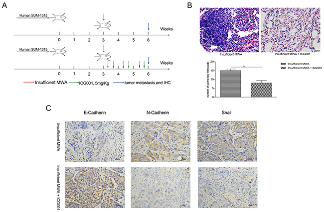 ICG001 inhibited insufficient MWA-induced distant metastasis in SUM-1315 nude mice models.