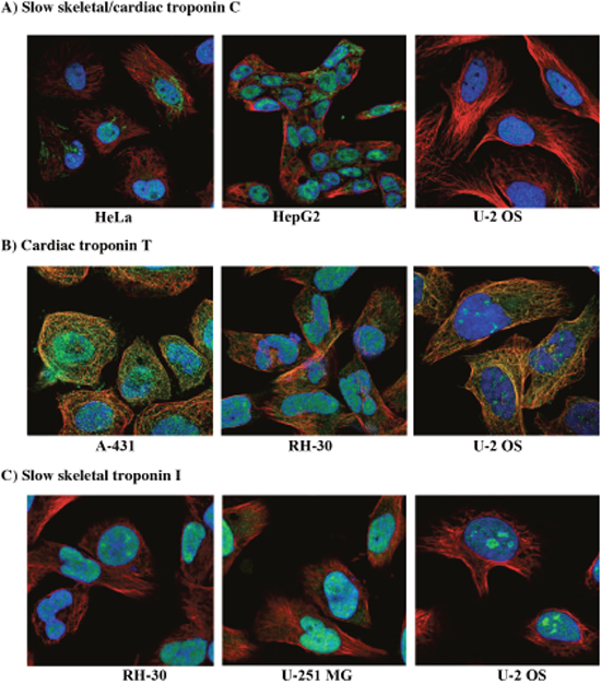 Immunocytochemistry images of troponin in human cancer cell lines.