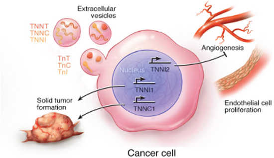 Schematic summary of the cellular processes associated with expression of troponin subunits in cancer cells.