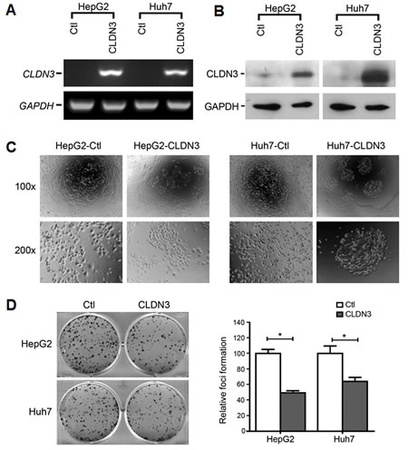 Fig.3: Morphological change and foci inhibition role of CLDN3 in HCC cells.