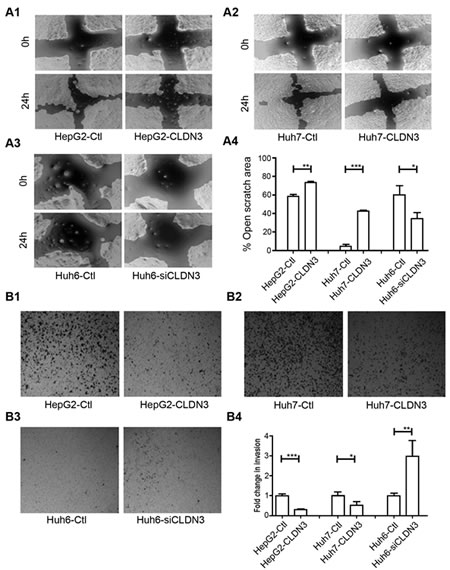Fig.4: CLDN3 inhibits cell mobility and invasiveness in HCC cells.