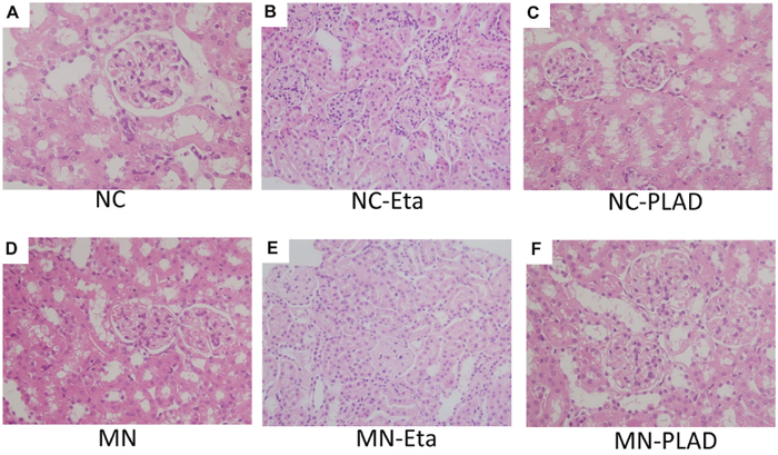 Changes in renal histopathology in mice with experimental MN as shown by H&#x0026;E staining.