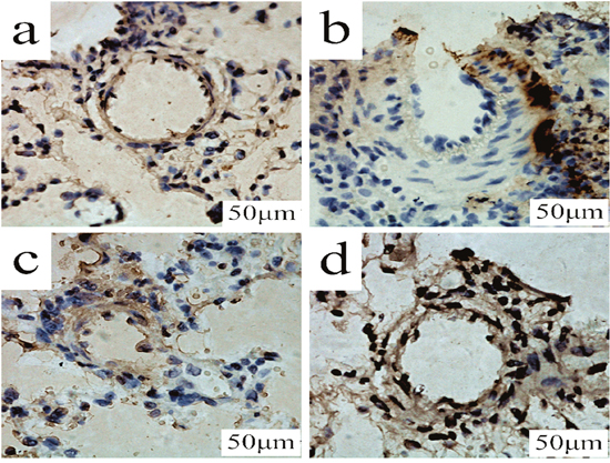 TUNEL determination of PCPA on apoptosis in lung tissues.