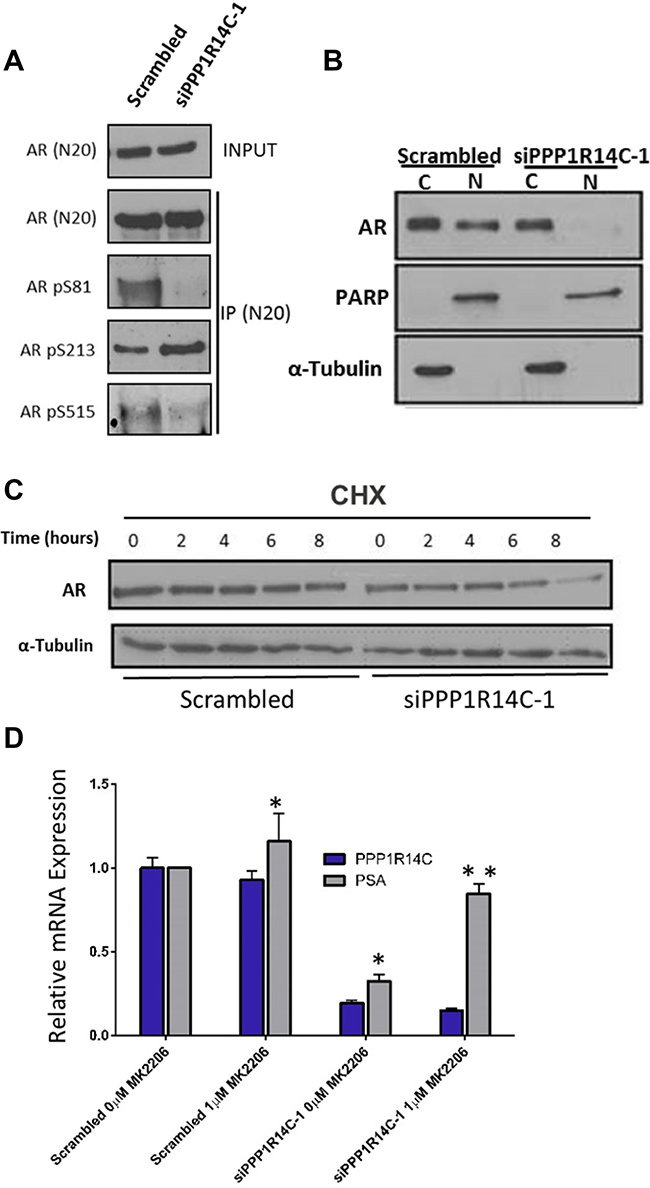 PPP1R14C RNAi depletion prevents cell cycle associated AR phosphorylation, reducing the proliferative and migratory capacity of prostate cancer cells.