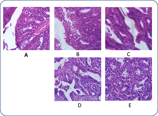 Histopathological photomicrographs of pathological rectal sections obtained after intraperitoneal injection of DMH solutions (haematoxylin and eosin (HE), &#x00D7; 40).