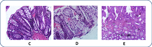 Histopathological photomicrographs of CRC rats after therapeutic treatment (HE, &#x00D7; 40).