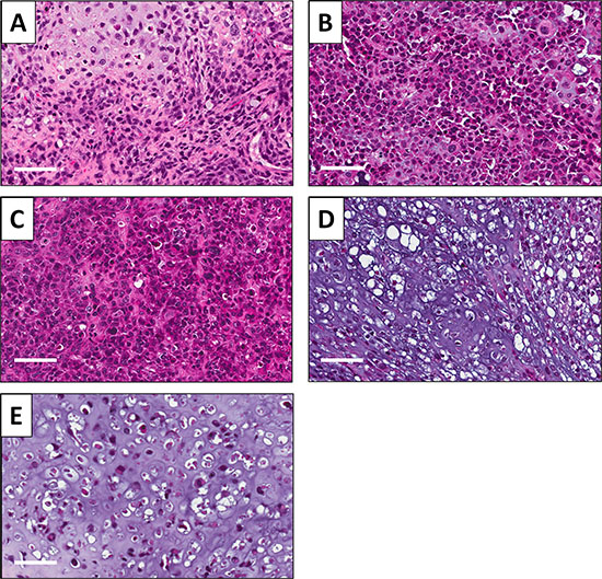 Effect of treatments on PDOX tumor histology.