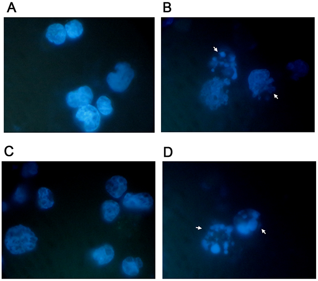 Apoptosis-associated nuclear condensation and fragmentation on Jurkat cells and HL-60 cells.