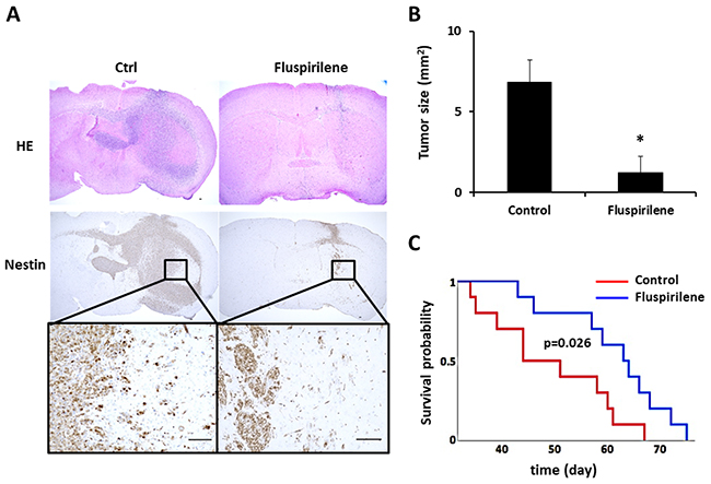 Effect of fluspirilene treatment on the GBM animal model.