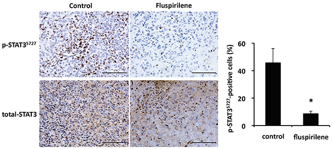 Inhibition of STAT3 activity by fluspirilene in mouse brain tumor.