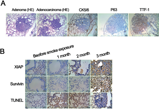 Validation of A/J mouse lung cancer model induced by smoke exposure.