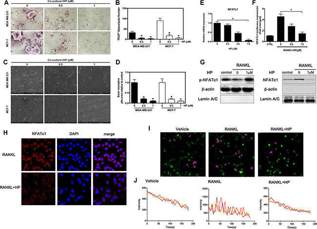 Hypericin inhibits breast cancer-induced osteoclast differentiation and function via suppression of the NFATc1 signaling pathway and attenuation of Ca2+ oscillation in osteoclasts.