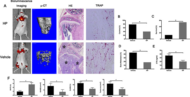 Hypericin reduces bone metastasis and increases survival in breast cancer-bearing mice.